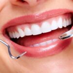 Benefits Of Cosmetic Dentistry: Beyond Aesthetics