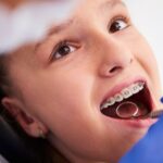 Common Orthodontic Issues and their Solutions